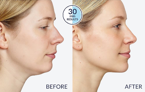 Soft Jaw | Overnight Lifting Band